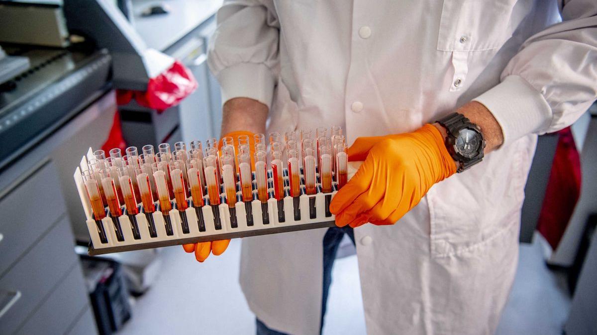 se schimba situatia in care ne testam pentru covid ce inseamna acum contact direct si cand este un