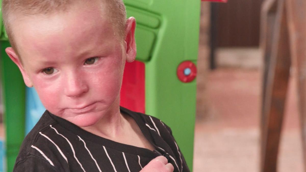 poveste dominic copilul care schimba un strat de piele pe zi