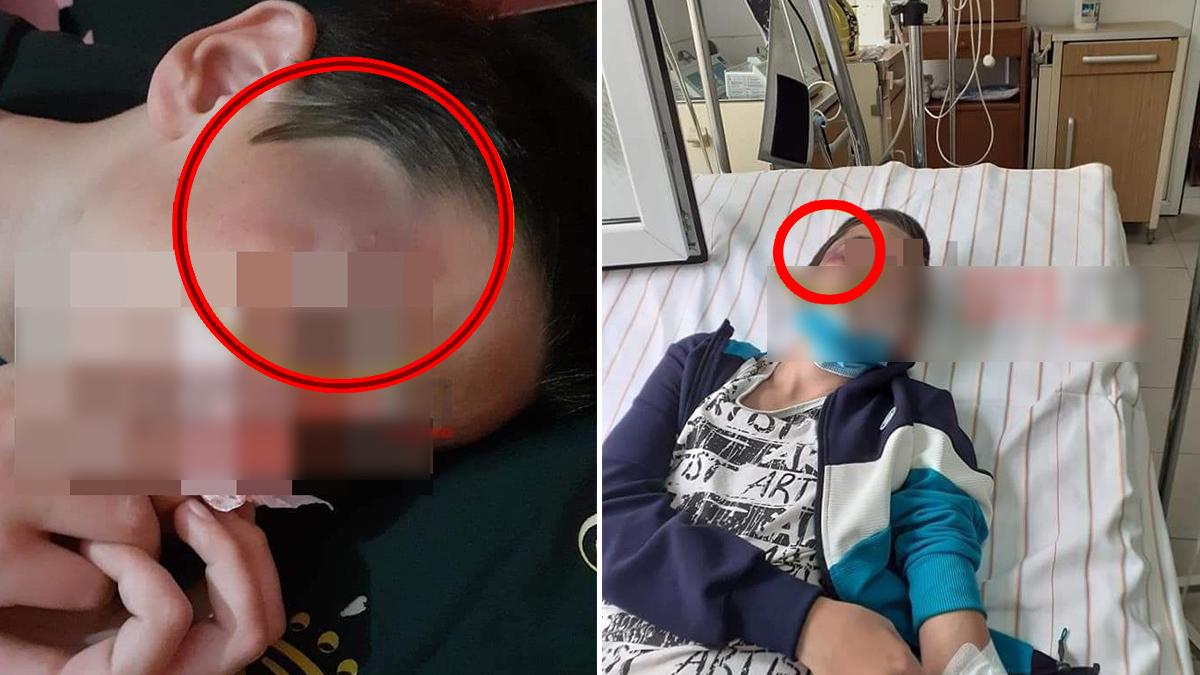 copil batut de tata vanatai machiat de mama