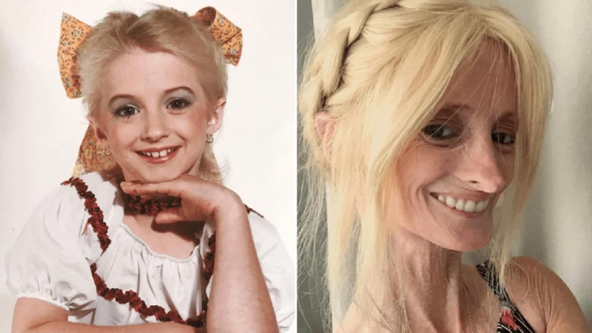 tiffany progeria boala rara sua