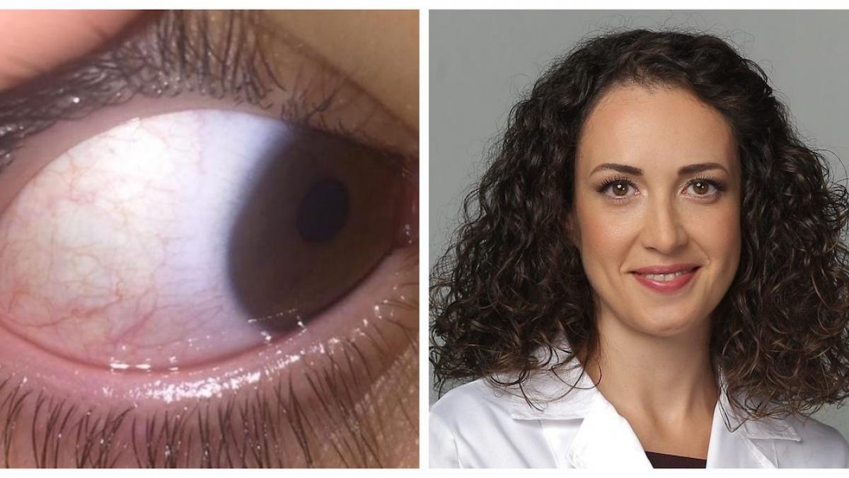 atentie ochi copil medic durere