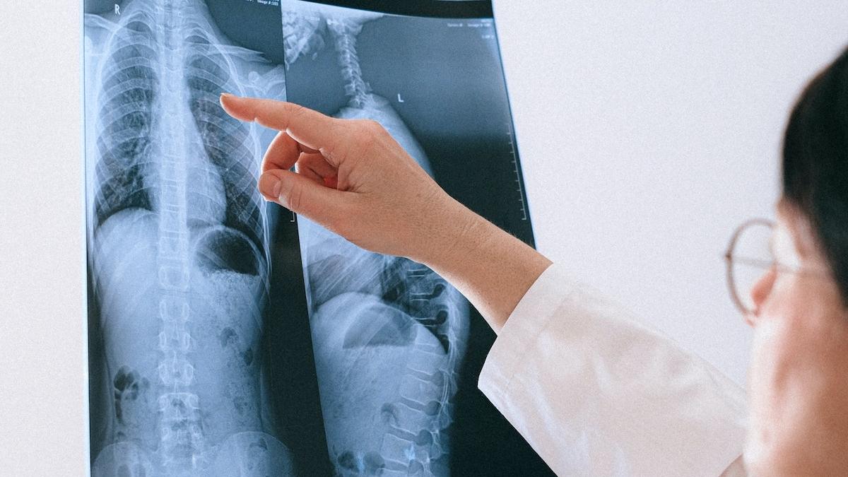 operatie premiera timisoara cancer