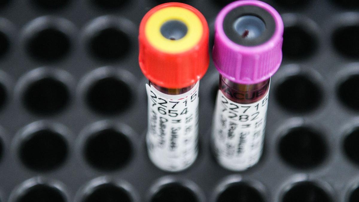 sputnik v alcool abstinenta rusia