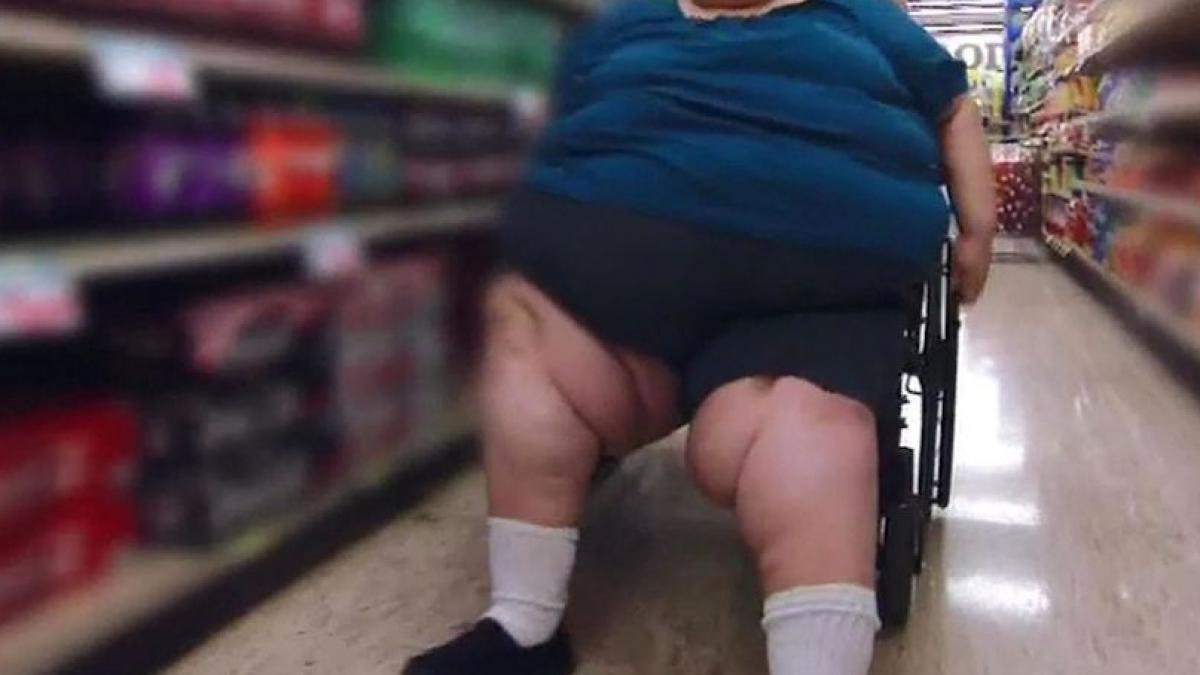 boala dureroasa obezitate femei