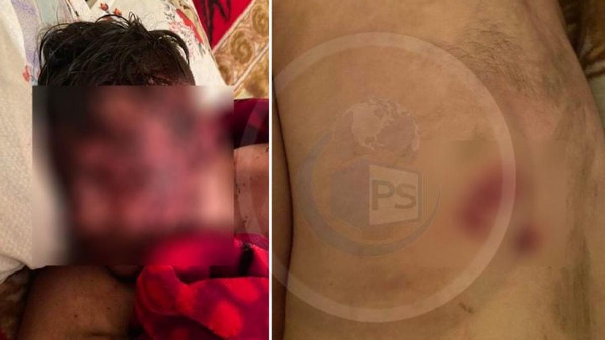 tanar 19 ani stare grava spital bataie petrecere