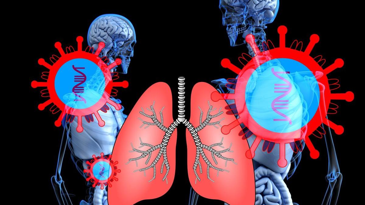 beatrice mahler imagini plamani covid fumatori