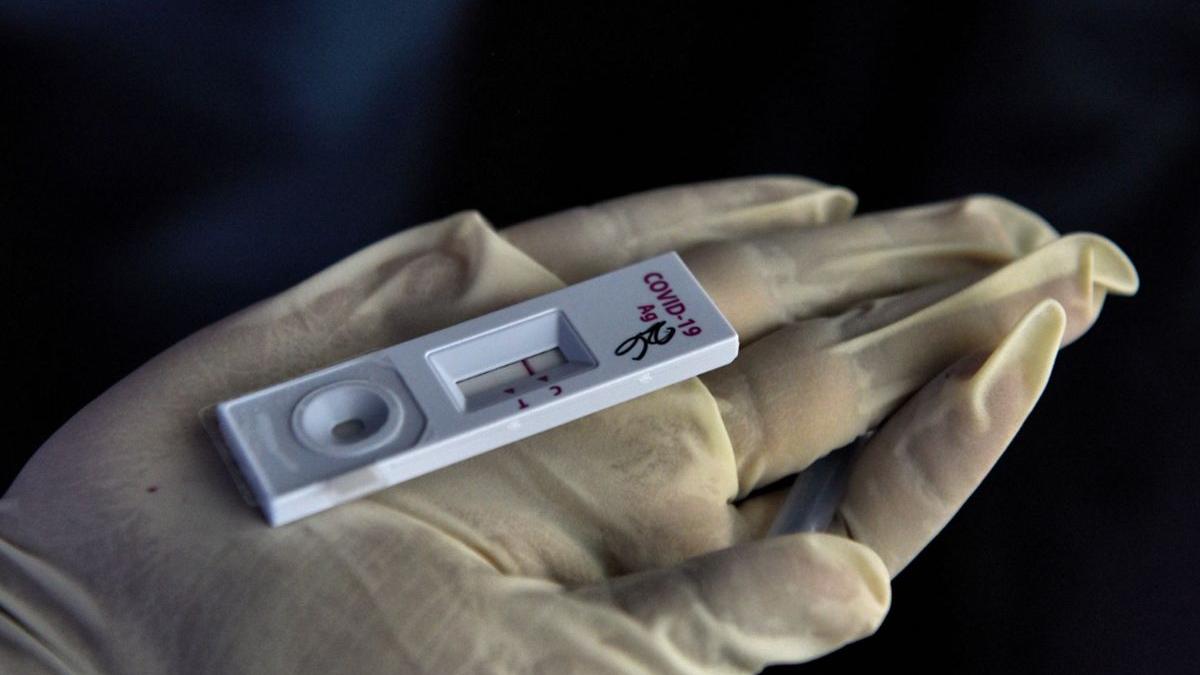 covid 19 test rapid antigen coronavirus