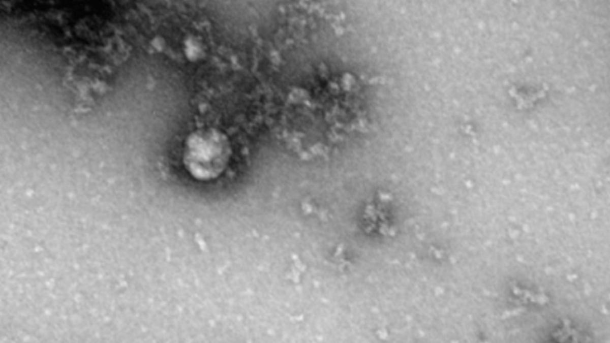 tulpina britanica covid 19 microscop