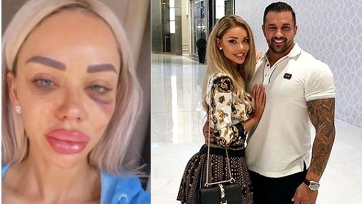 alex bodi scandal bianca dragusanu fotografii bataie