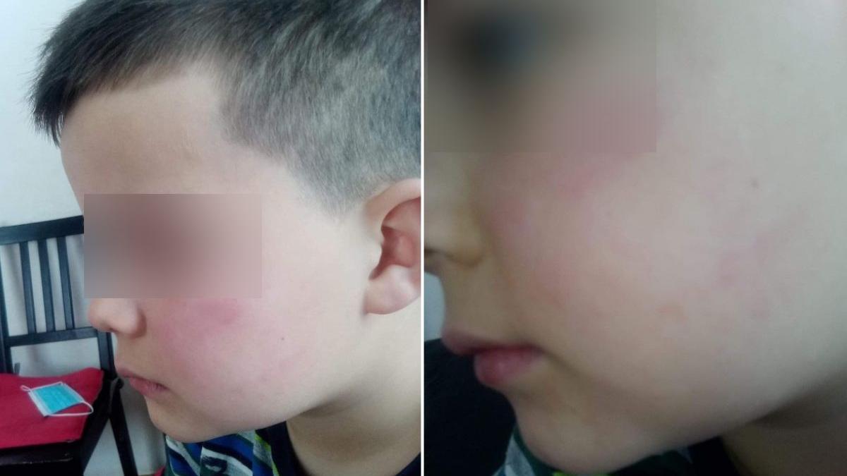 baietel lovit tata colega clasa invatatoare