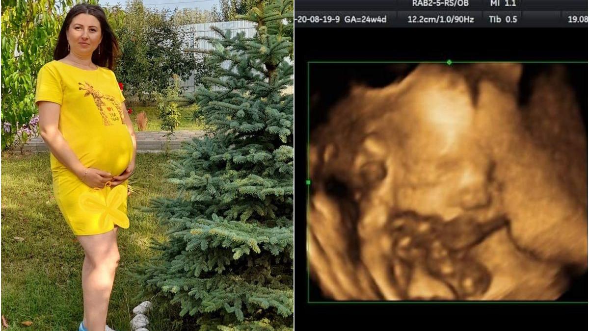 gravida iasi copil mort medici