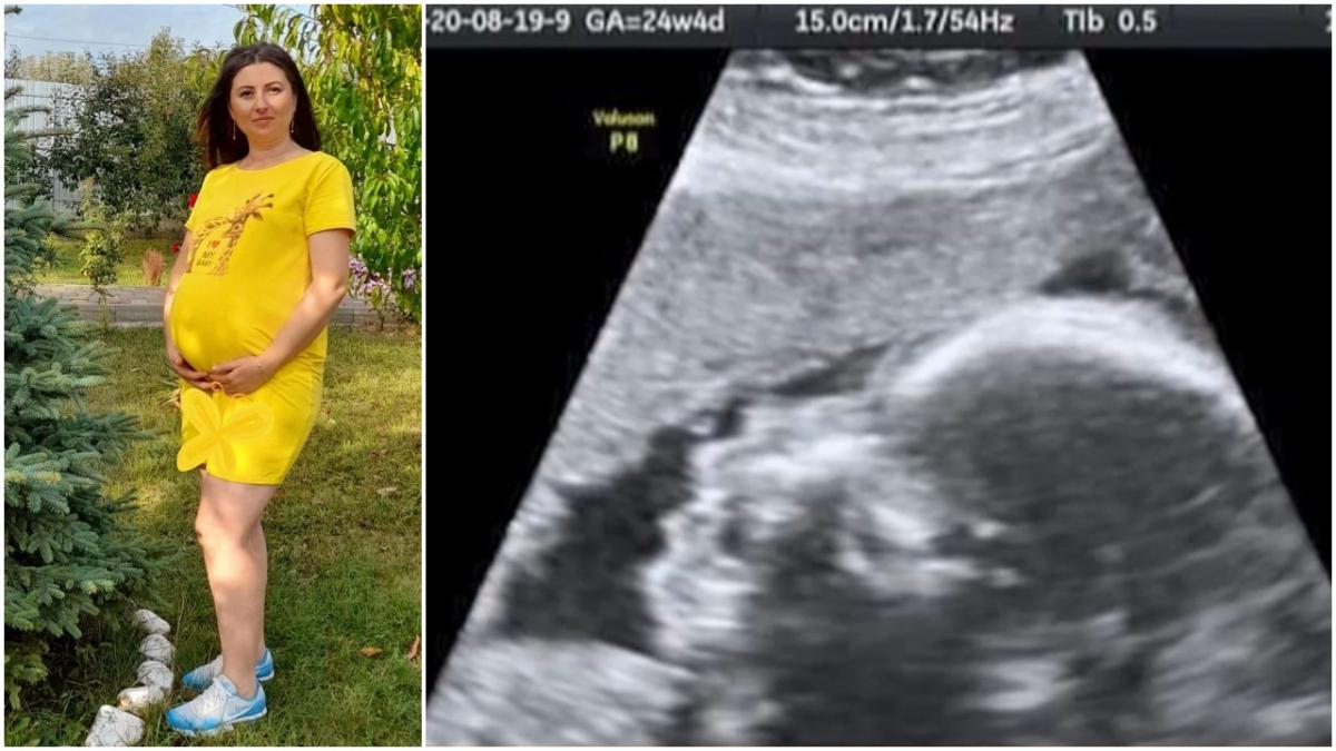 marturie mama iasi mirunica