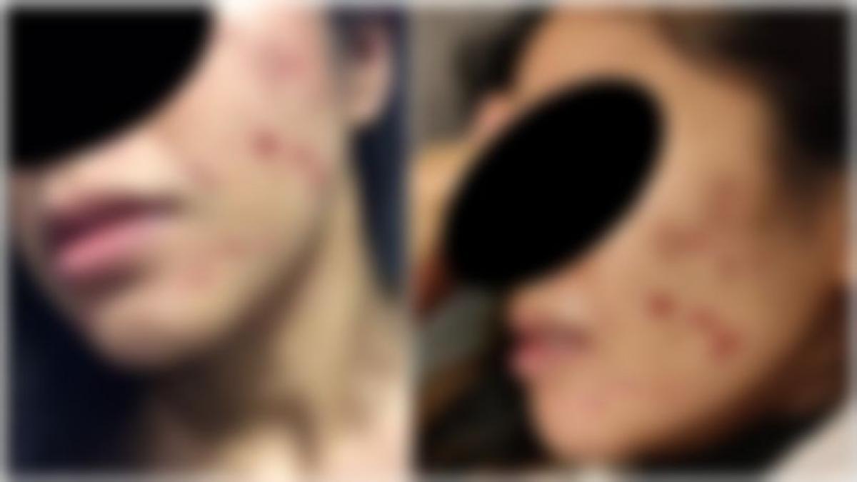 studenta medicina agresata parc timisoara