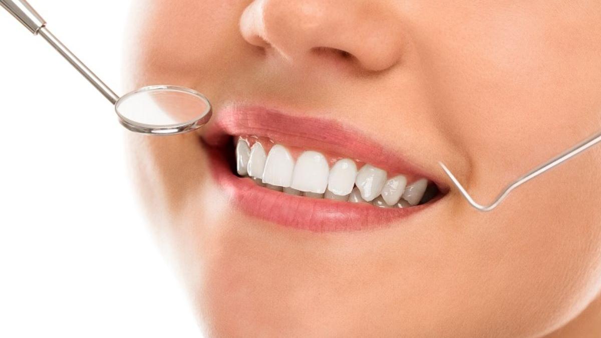 tipuri implanturi dentare solutia potrivita pentru tine