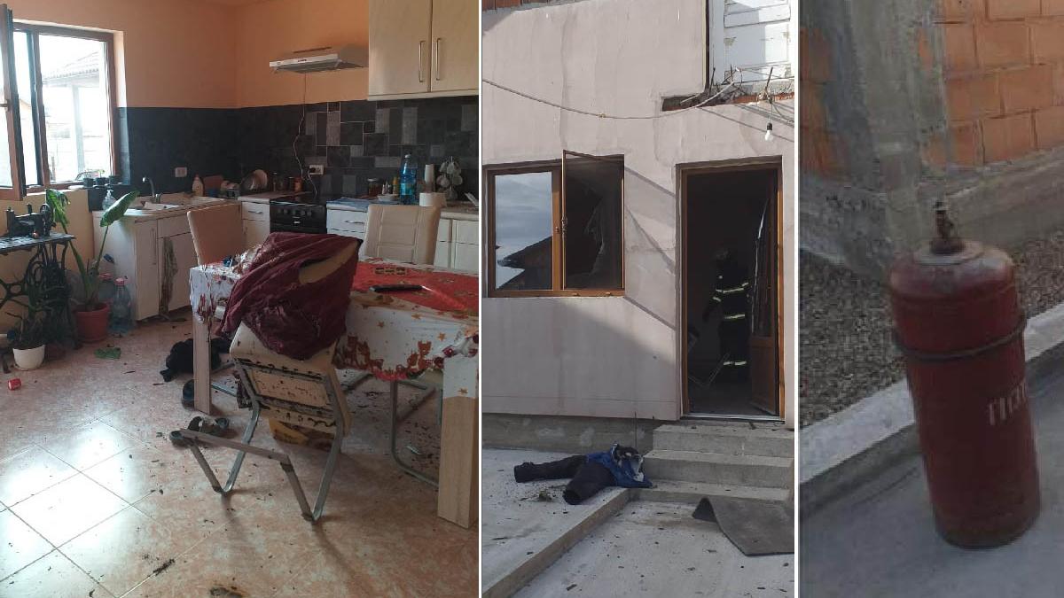 barbat arad butelie explozie arsuri spital