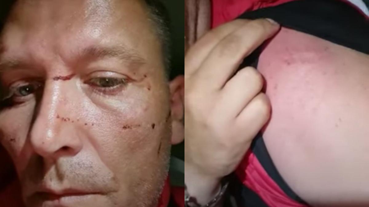 barbat ocna mures batut pierdere cunostinta strada