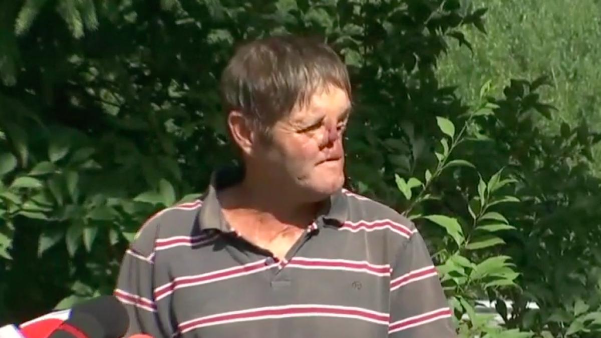 desfigurat urs la 15 ani operat 80 de ori spitale trei tari muscat de fata