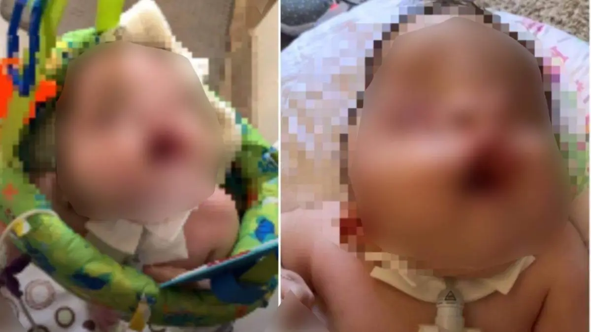 mama unui copil cu probleme ale dezvoltarii creierului mi au spus sa imi ucid copilul doar pentru