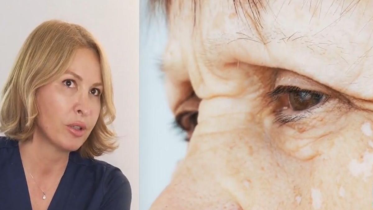 melasma dermatolog adina alexandru