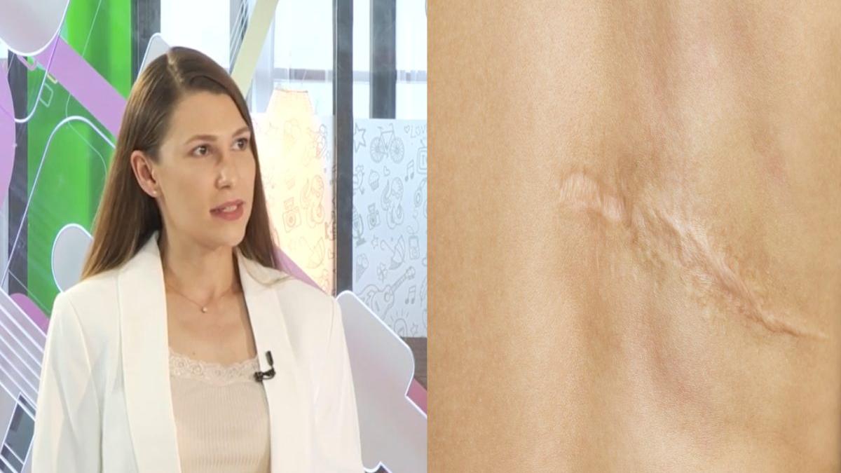 cicatrici cheloide tratare mihaela dancaescu