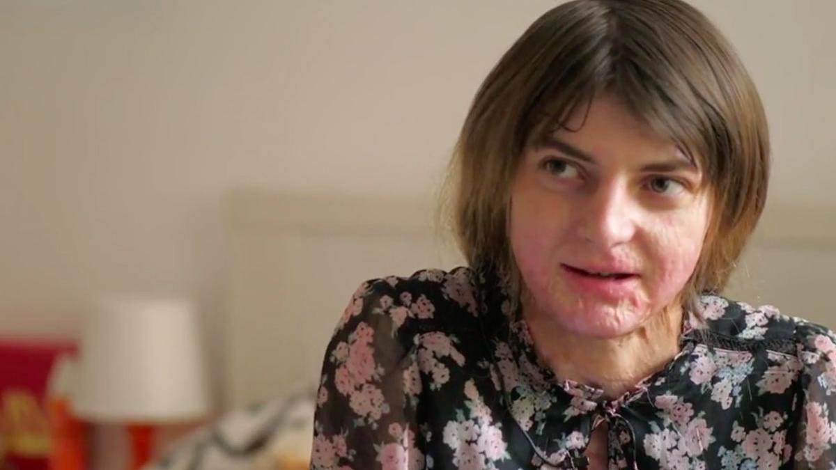 la 17 ani incendiata de criminalul recidivist ion turnagiu medicii nu ii dadeau sanse mariuca