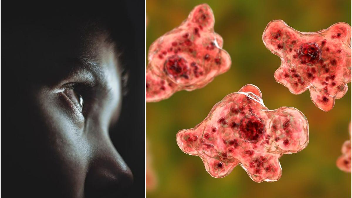 copil sapte ani mort amiba california