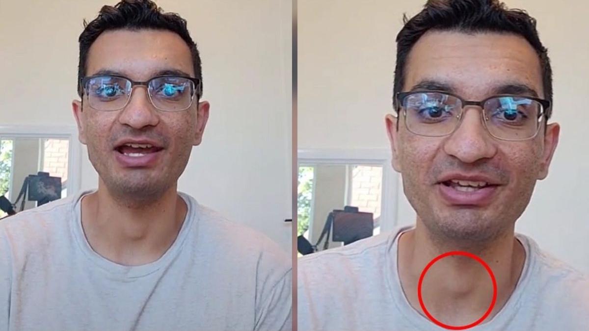 un tanar a aflat pe tiktok crunta veste ca are cancer urmaritorii i au recomandat niste analize