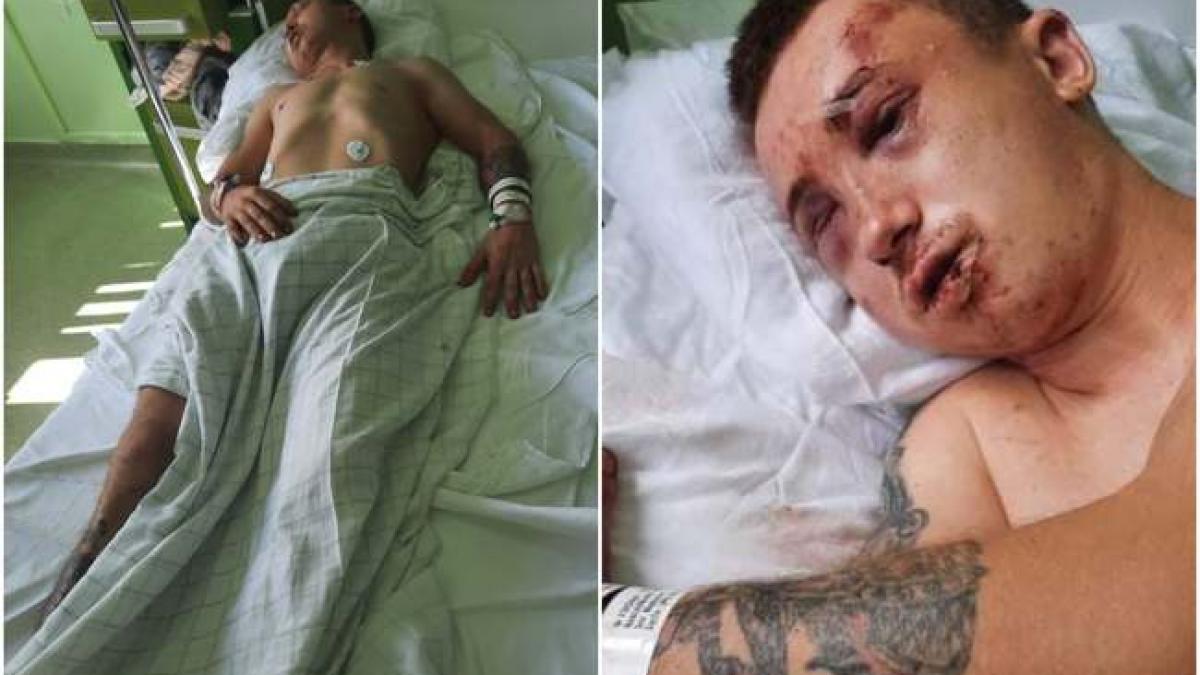 baiat batut dezbracat incendiat trotuar arad