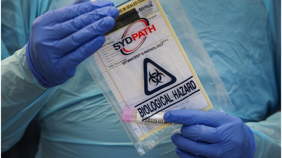 instagram covid proces