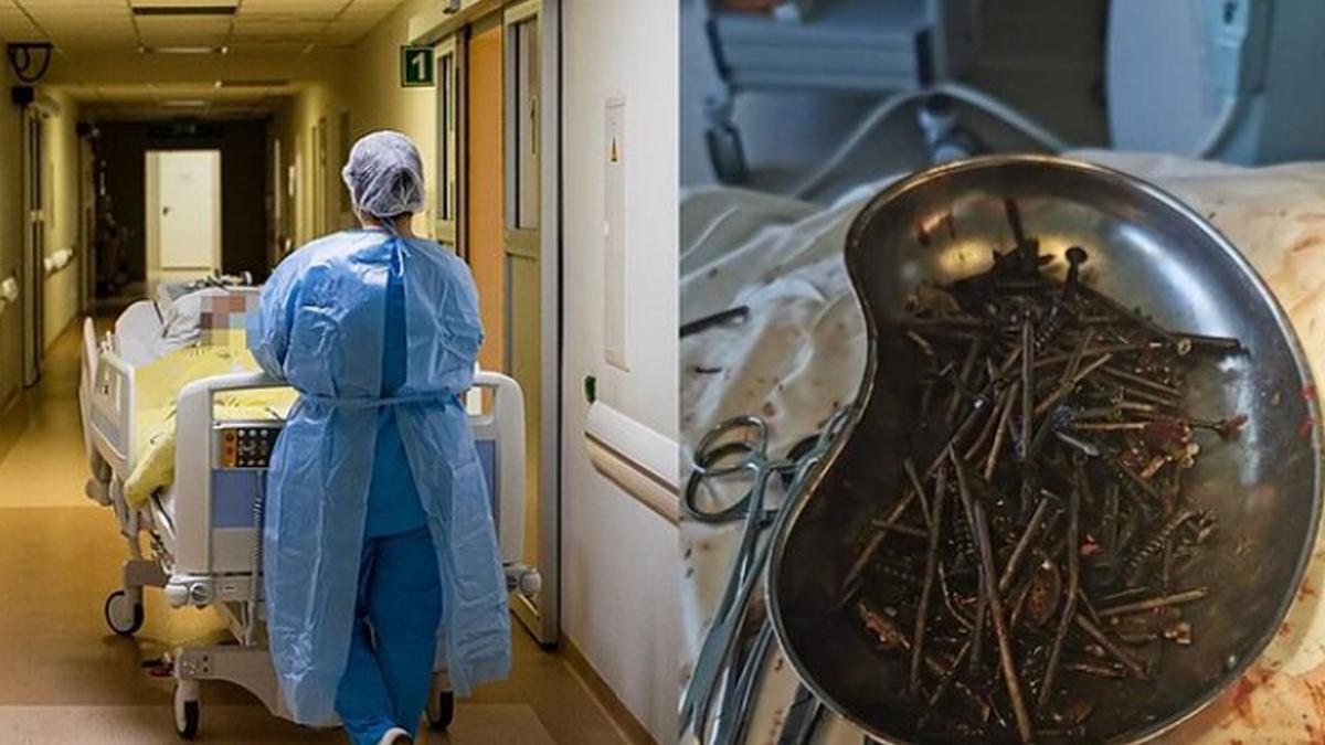 cuie si suruburi stomac barbat lituania