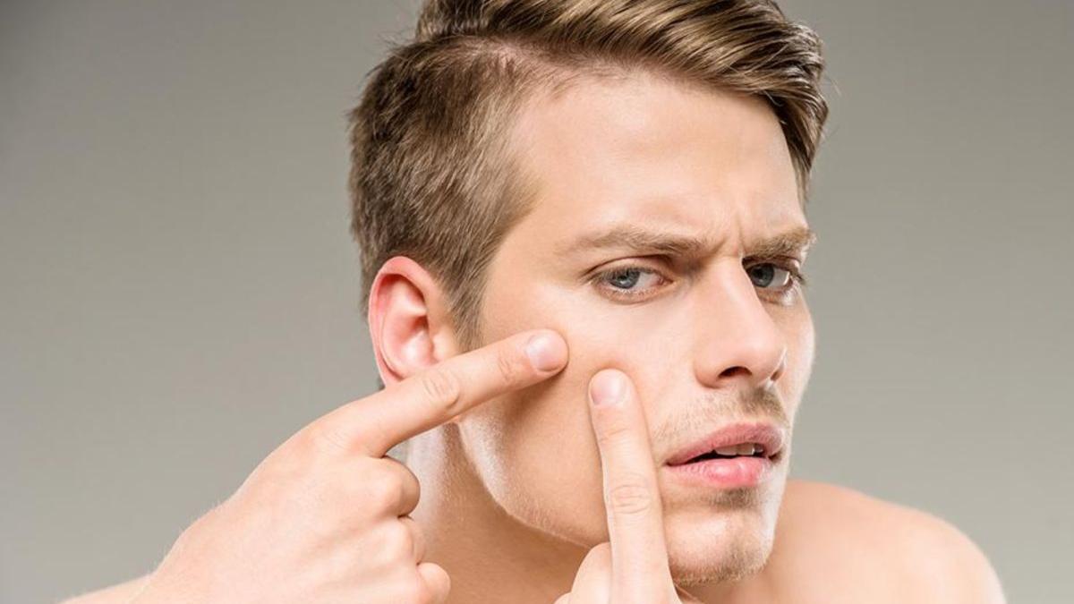 top cauze si tratament acnee