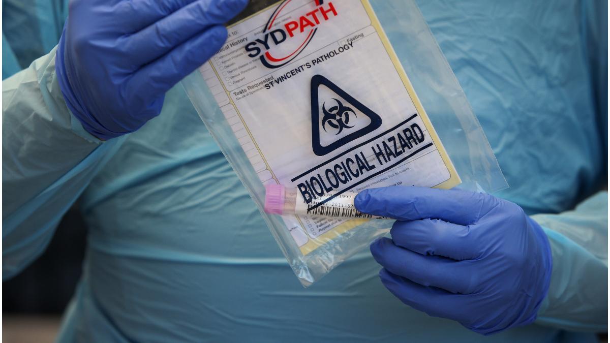 omicron prime simptome usoare