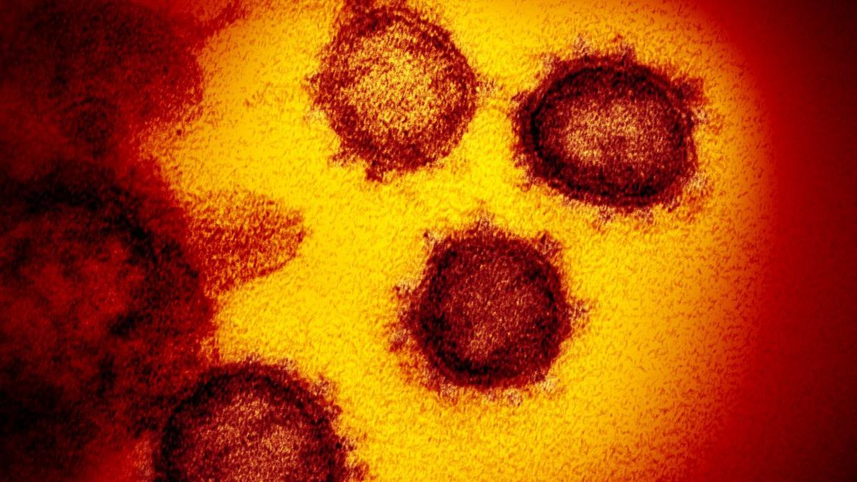 deltacron noua tulpina de coronavirus descoperita la 25 de oameni din cipru