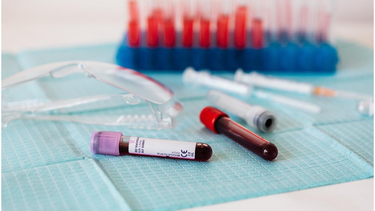 test sange pacienti covid