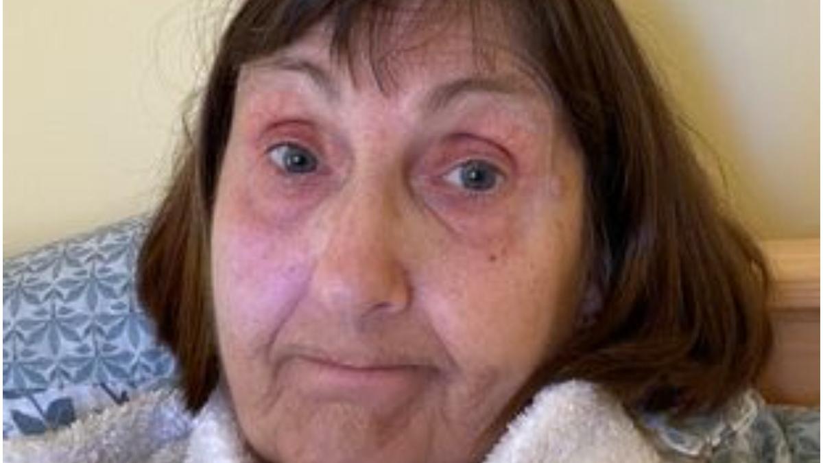 pensionara bolnava cancer factura