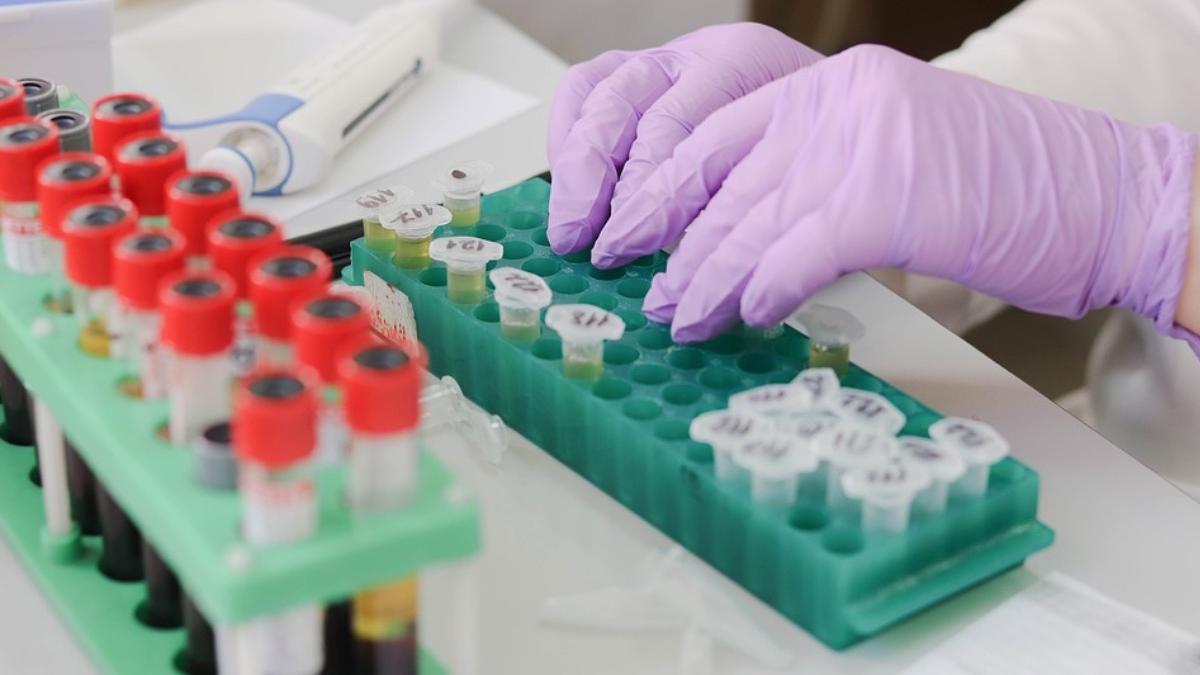 cauza pierdere brusca greutate pacienti cancer descoperita cercetatori