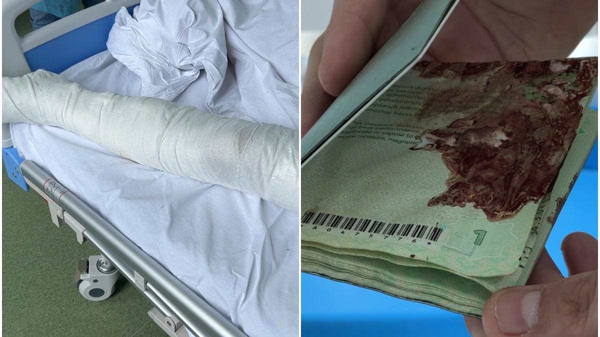 tanar impuscat kiev mers 5 zile jos ajunge romania