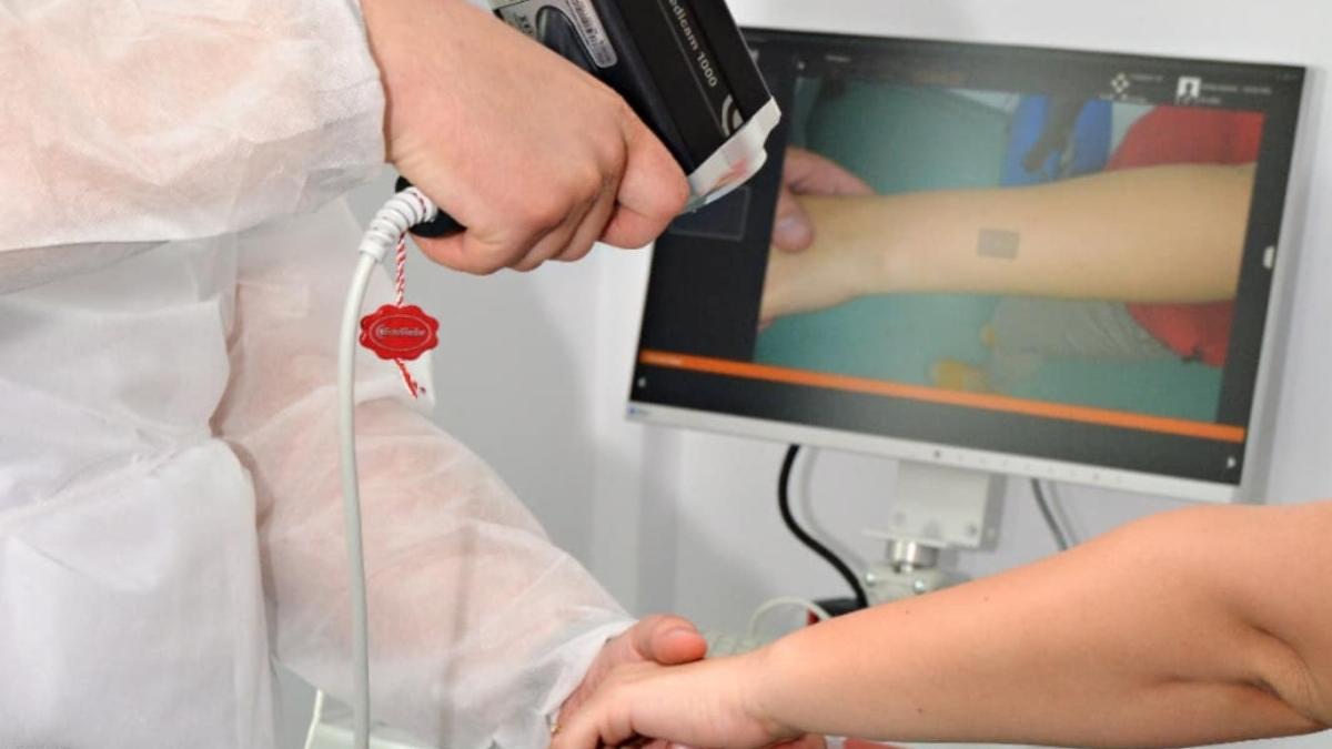 spital din galati aparat unic in romania cancer de piele