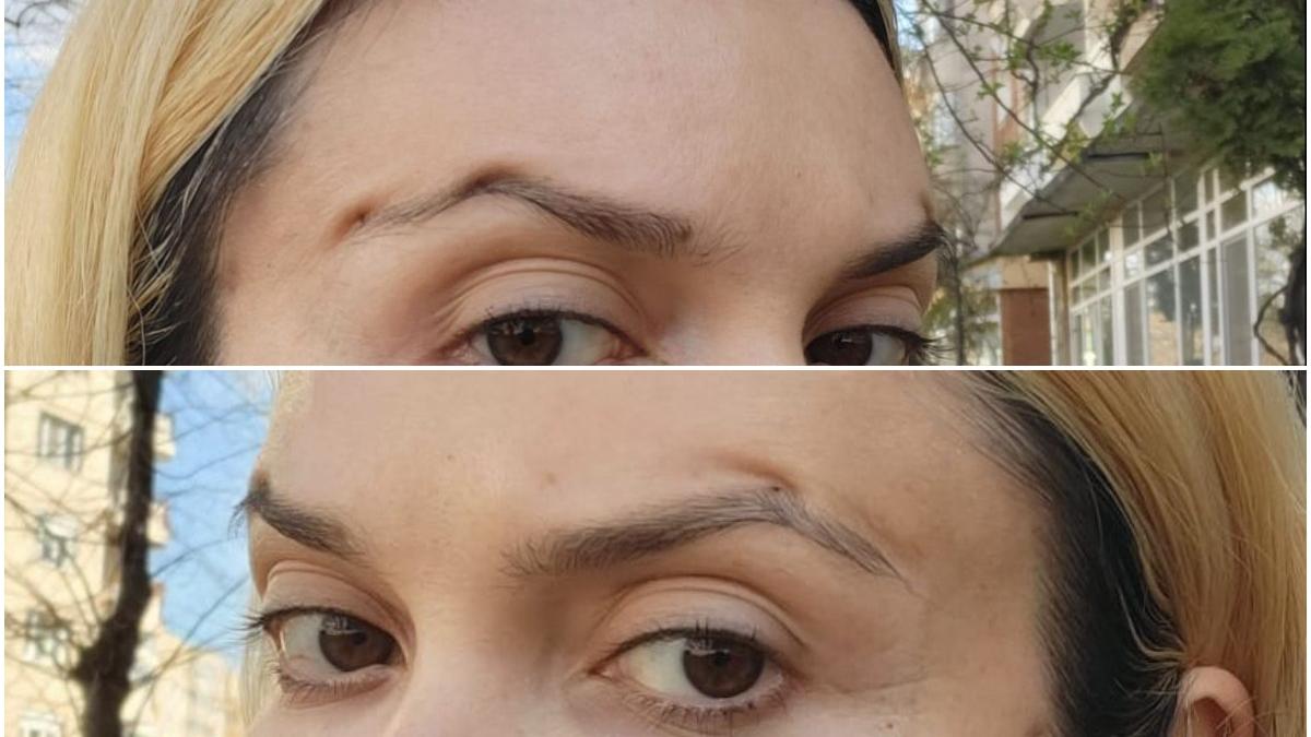 pacienta mutilata operatie facuta medic fals platit 2 000 euro