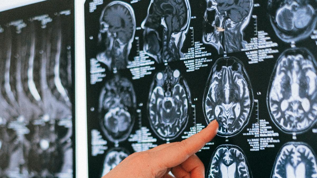 otrava din mancare adiviti alimentari e621 glutamatul monosodic obezitate