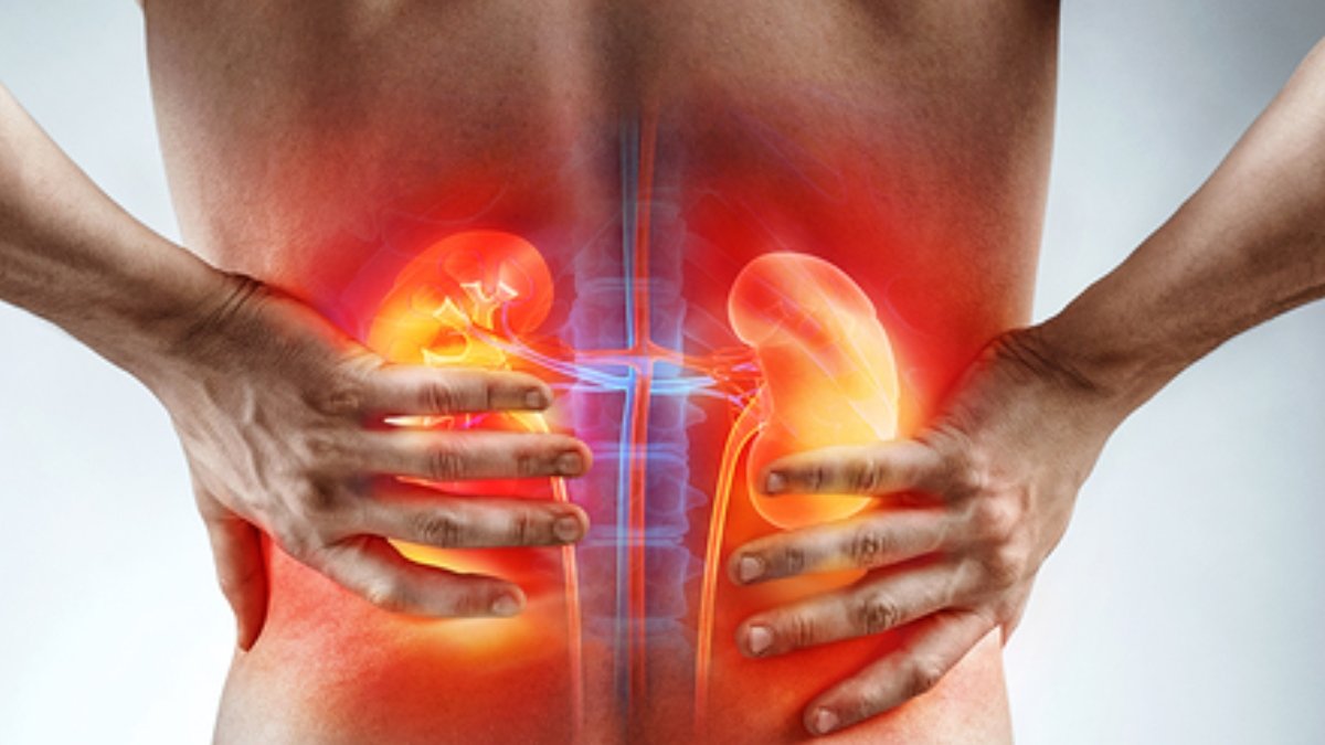 Simptomul care face diferenţa între durerea de spate de rinichi | Precizările unui cunoscut medic urolog