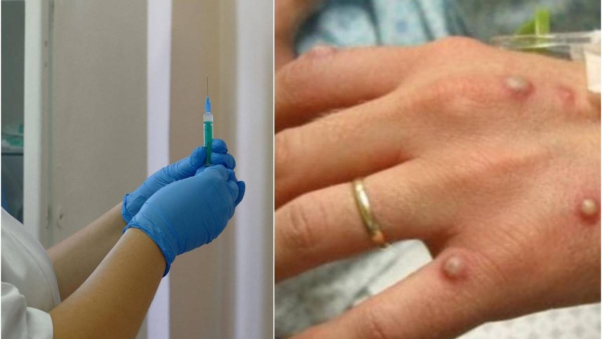 romania cumpara vaccin variola maimutei