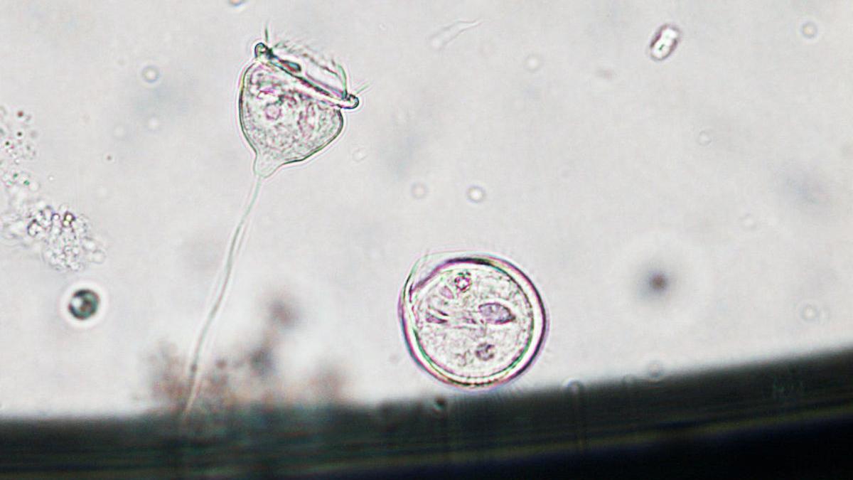 bacteria ucigasa luata dus camera hotel mare atentie cazare