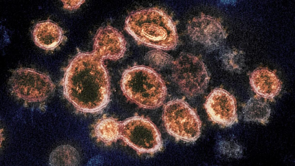 boala cumplita marea britanie epidemie variola maimutei