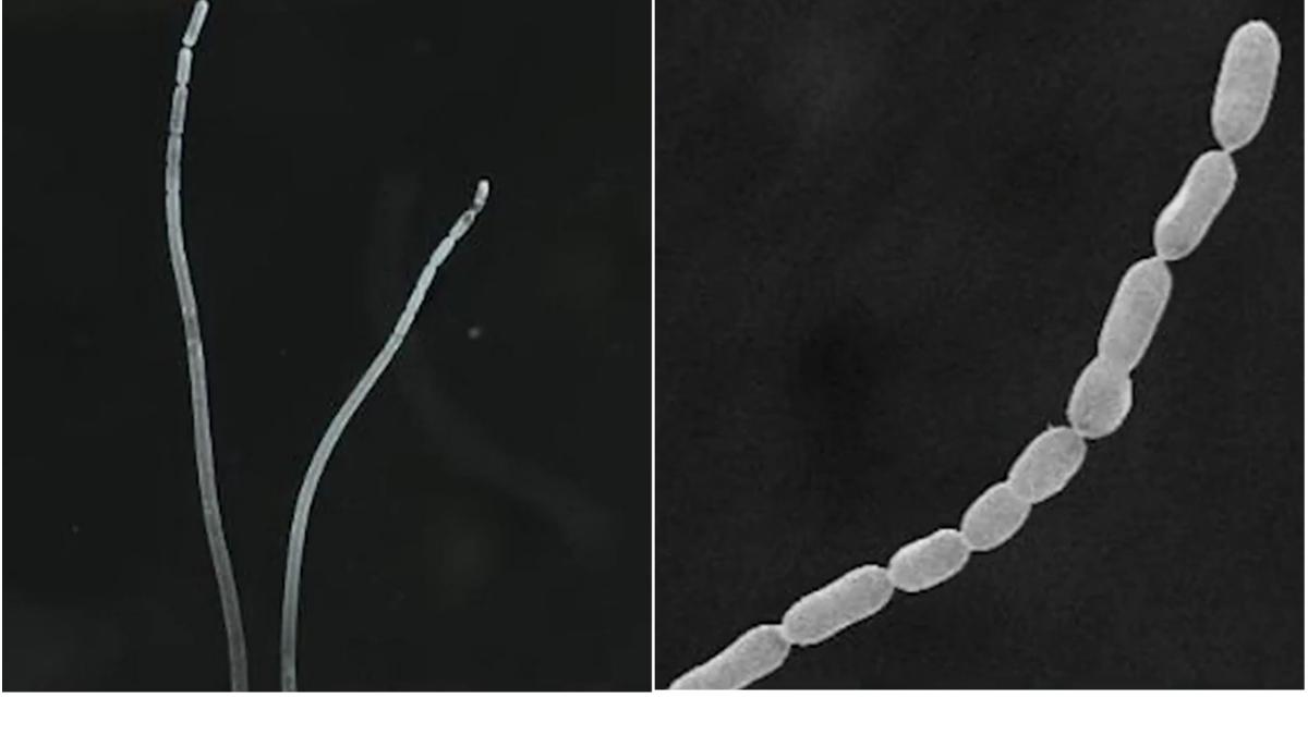 cercetatori descoperire cea mai mare bacterie lume thiomargarita magnifica