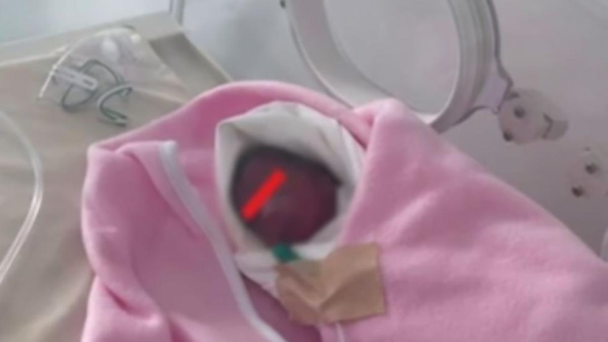 bebelus prematur constanta spital harsova