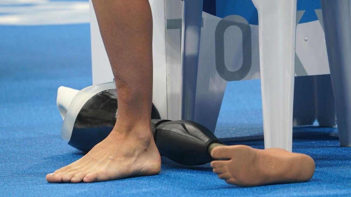 pacient spania spital amputat picior