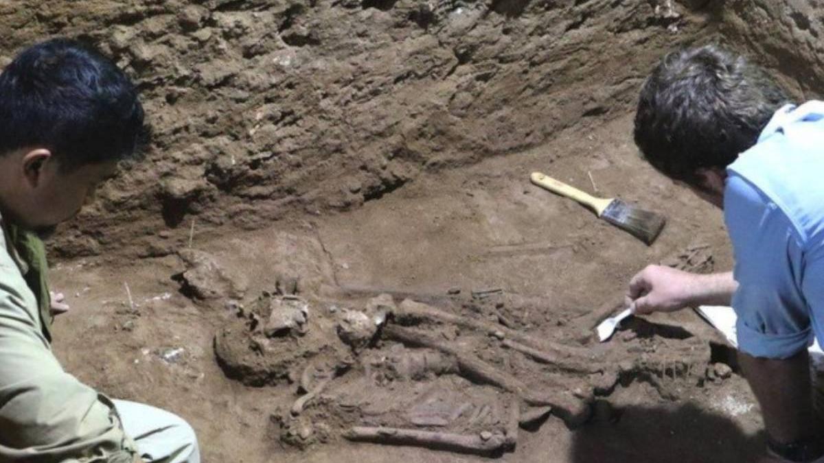 amputare chirurgicale cea mai veche 31 000 de ani