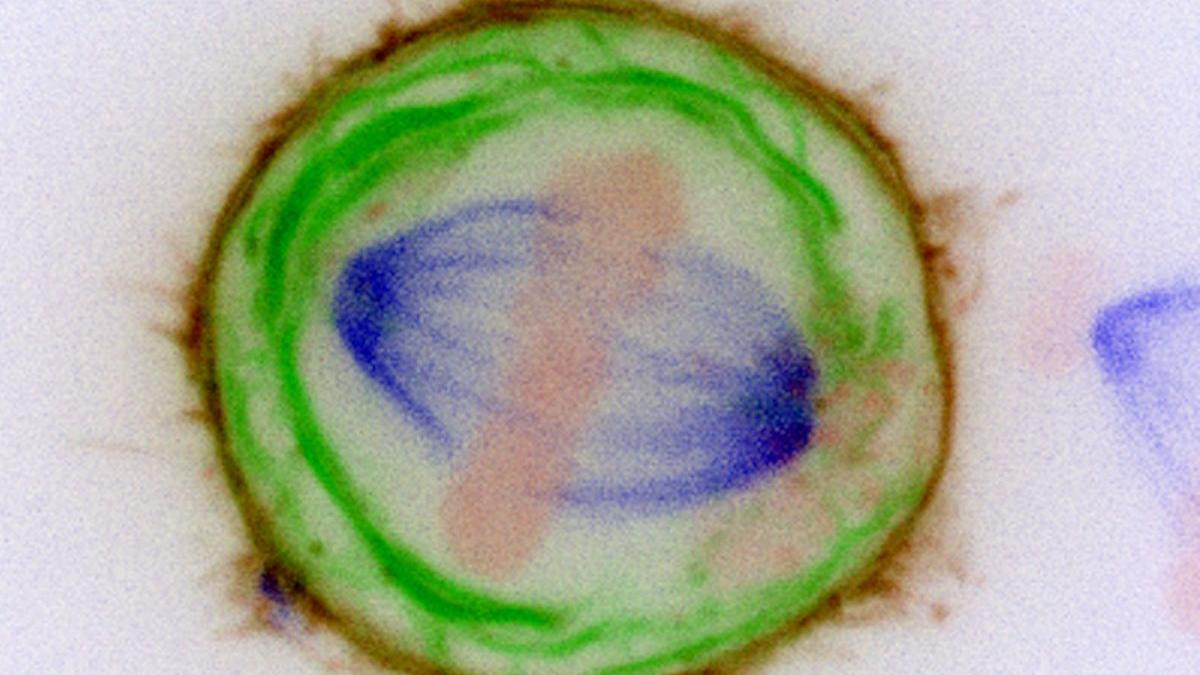 testul galleri cancer sange