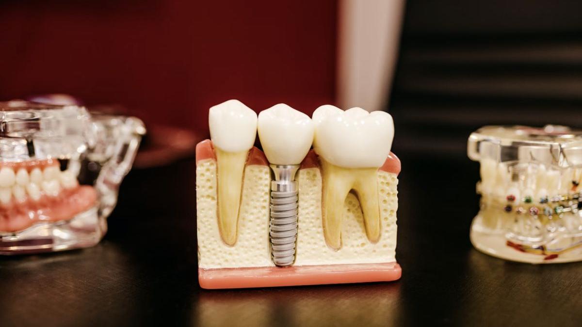 patru cauze mai putin stiute ale parodontozei la ce sa fii atent